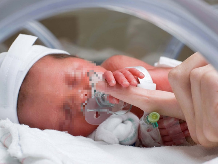 Dấu hiệu trẻ viêm phổi nặng cần đưa ngay đến bệnh viện- Ảnh 1. Dấu hiệu trẻ viêm phổi nặng cần đưa ngay đến bệnh viện- Ảnh 1.