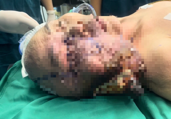 Ca phẫu thuật mang lại 'trang mới' cho cuộc đời nữ bệnh nhân- Ảnh 2.