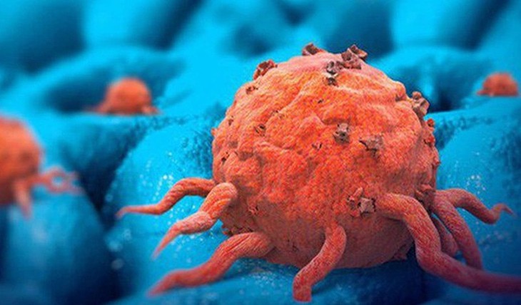 Thuốc điều trị Hội chứng Carcinoid- Ảnh 1.