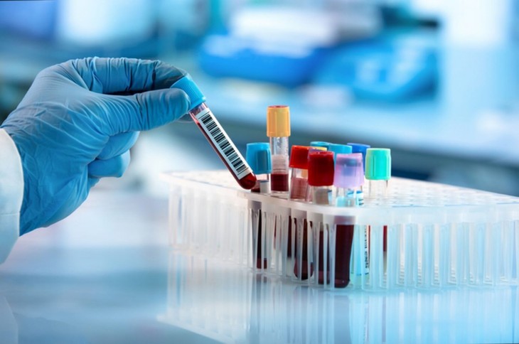 Chế độ ăn cho bệnh nhân Leukemia kinh dòng bạch cầu hạt- Ảnh 1. Chế độ ăn cho bệnh nhân Leukemia kinh dòng bạch cầu hạt- Ảnh 1.