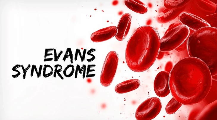 6 câu hỏi thường gặp về hội chứng Evans- Ảnh 1.