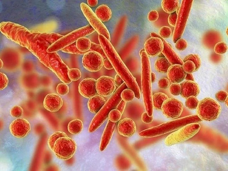 WHO bác thông tin về virus lạ gây triệu chứng ho ra máu ở Nga- Ảnh 1.