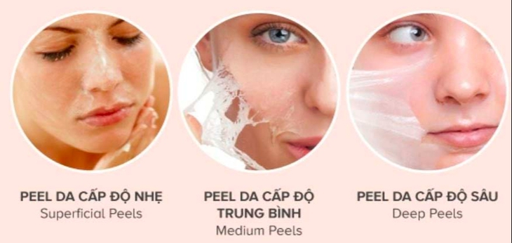Ưu điểm và rủi ro khi peel da- Ảnh 1.