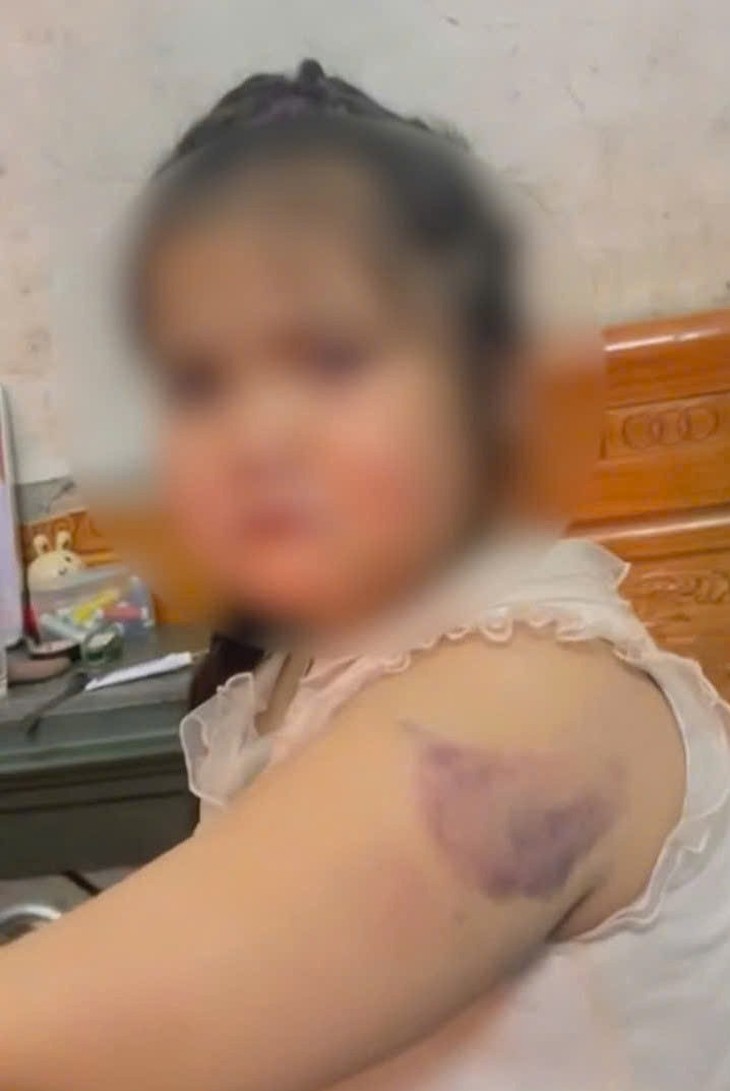 'Lá chắn' nào bảo vệ học sinh khỏi bạo hành từ giáo viên?- Ảnh 1.