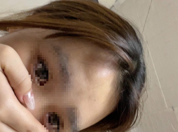 Xác minh vụ nữ sinh bị đánh nhập viện vì mâu thuẫn tiền tip tại nhà hàng ở Hà Nội- Ảnh 2.