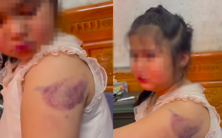 "Lá chắn" nào bảo vệ học sinh khỏi bạo hành từ giáo viên?