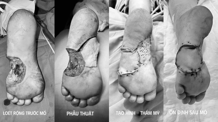 Nốt ruồi nhỏ khiến người phụ nữ suýt mất chân- Ảnh 3.