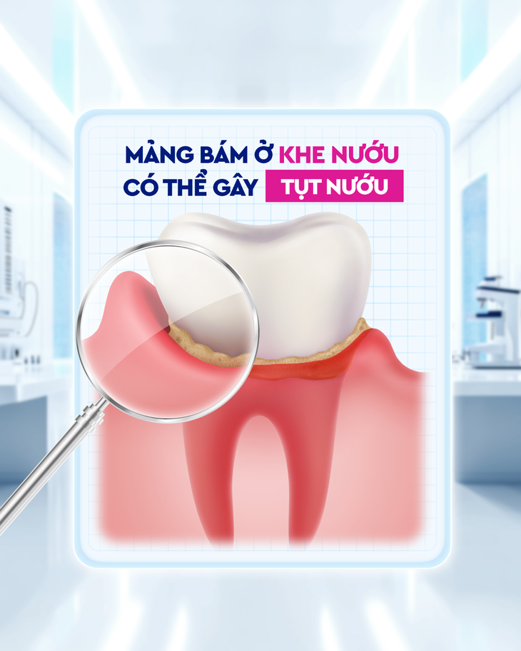 Đừng thờ ơ: Dấu hiệu 'tố cáo' bệnh răng miệng nguy hiểm, chớ coi thường!- Ảnh 1.