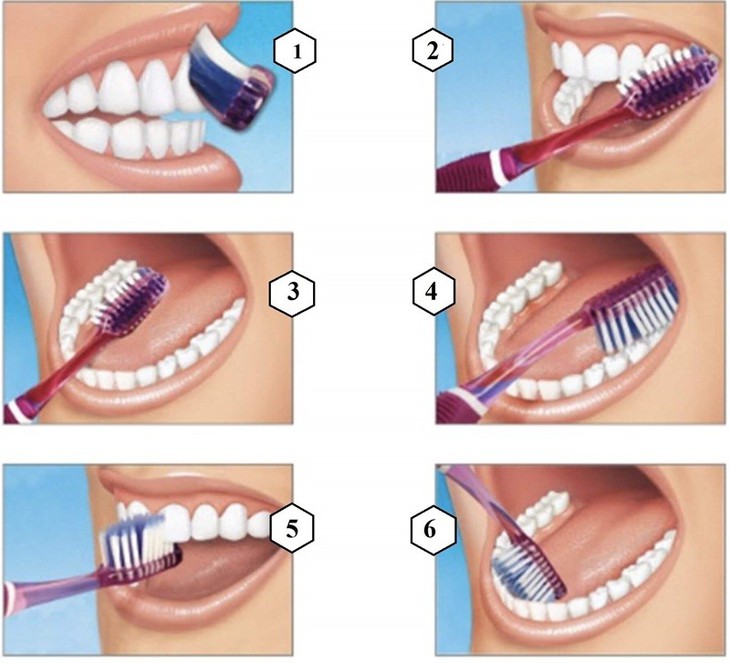 Chăm sóc răng miệng: Đánh răng thôi đã đủ chưa?- Ảnh 3.