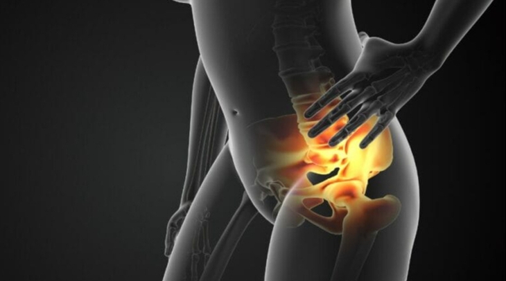 Chèn ép dây thần kinh thẹn cần lưu ý gì về chế độ ăn?- Ảnh 1.