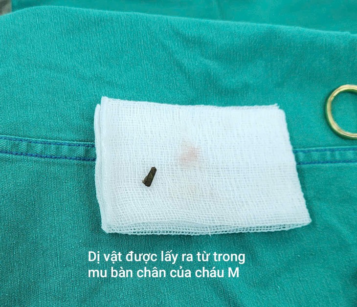 Mẩu gỗ nhỏ xíu đâm vào chân khi đá bóng khiến bé 7 tuổi co giật, nguy kịch- Ảnh 2. Mẩu gỗ nhỏ xíu đâm vào chân khi đá bóng khiến bé 7 tuổi co giật, nguy kịch- Ảnh 2.
