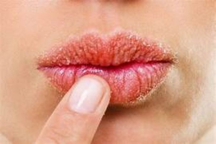 Dùng son môi nhiều có ảnh hưởng đến sức khỏe không?- Ảnh 3.