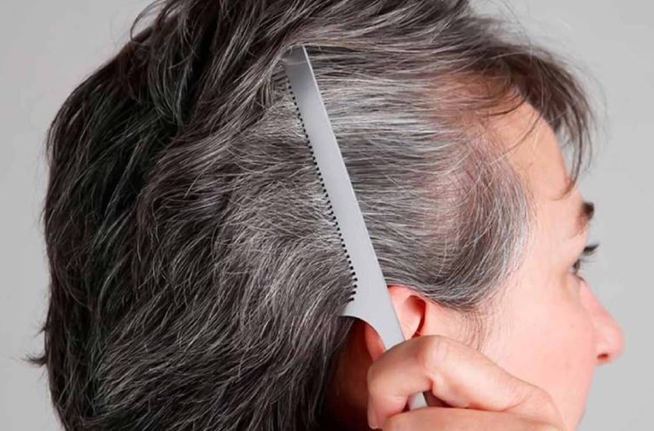 Rụng tóc tuổi già và cách khắc phục- Ảnh 2.