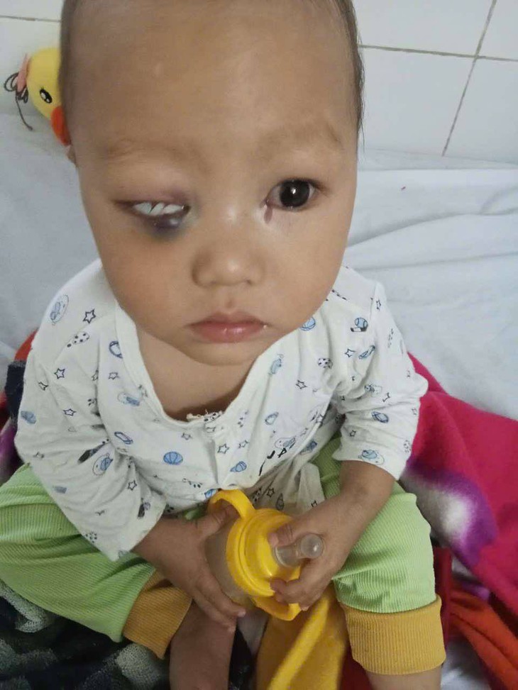 Bé 2 tuổi bị ung thư võng mạc, cha mẹ nghèo bán đàn lợn cũng không đủ tiền chữa trị- Ảnh 1. Bé 2 tuổi bị ung thư võng mạc, cha mẹ nghèo bán đàn lợn cũng không đủ tiền chữa trị- Ảnh 1.