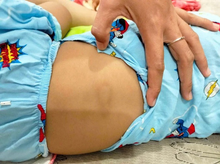 Vụ bé gái ở Bình Thuận chấn thương 'vùng kín': Công an mời người giữ trẻ lên làm việc- Ảnh 2. Vụ bé gái ở Bình Thuận chấn thương 'vùng kín': Công an mời người giữ trẻ lên làm việc- Ảnh 2.