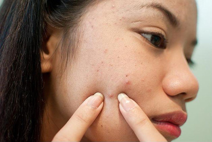 Thói quen sờ tay lên mặt gây hại gì cho làn da?- Ảnh 3.
