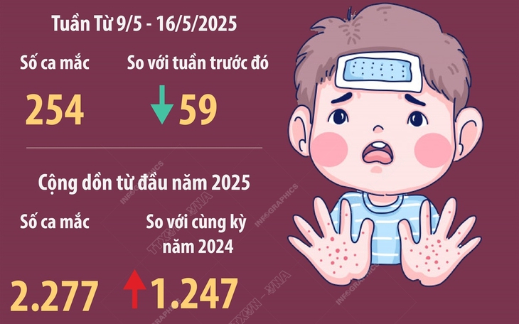 Hà Nội: 254 ca mắc tay chân miệng trong một tuần