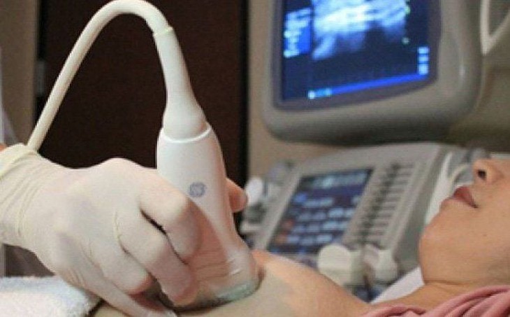 9 điều cần tránh trong kỳ kinh nguyệt để giảm đau và thoải mái hơn- Ảnh 3.