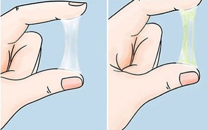 Khí hư ra nhiều do đâu?