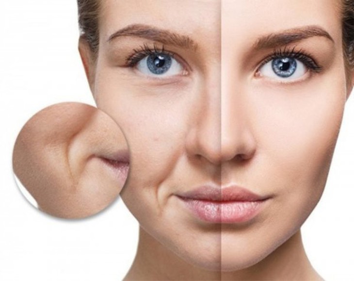 6 thói quen hằng ngày giúp giảm nếp nhăn quanh miệng- Ảnh 3.