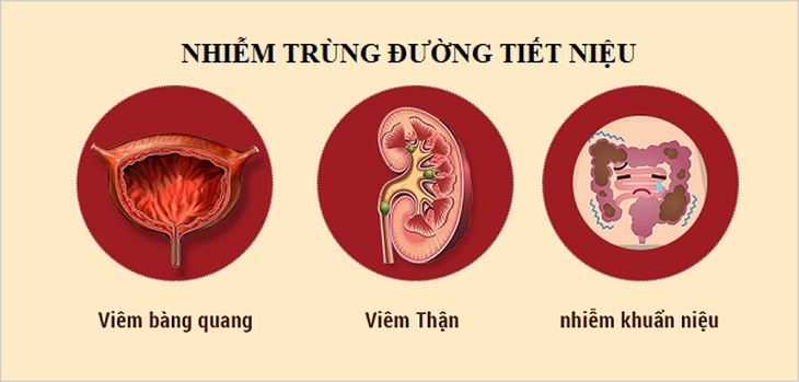 4 món ăn bài thuốc hỗ trợ trị tiểu buốt, tiểu rắt- Ảnh 1.