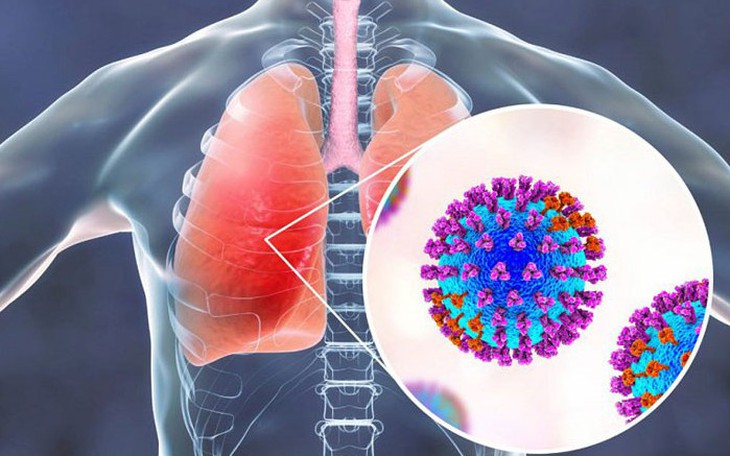 Nhận biết các viêm nhiễm đường hô hấp dưới thường gặp
