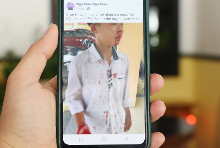 Người đàn ông đánh cậu bé hàng xóm chảy máu vì mâu thuẫn của con nhỏ- Ảnh 1.