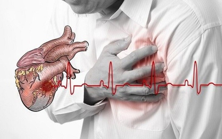 Các yếu tố nguy cơ gây nhồi máu cơ tim