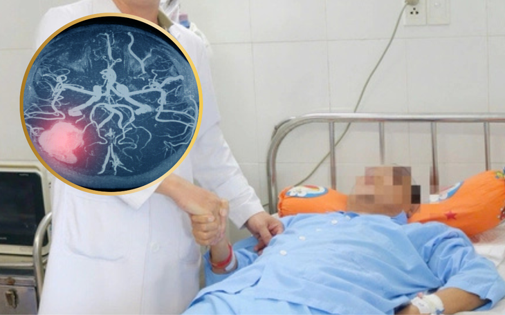 Cứu sống bé gái 6 tuổi bị chấn thương sọ não nặng sau tai nạn ngã xe- Ảnh 2.