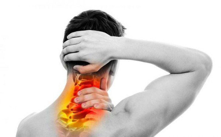 Suýt liệt tay chân do thoát vị đĩa đệm cổ- Ảnh 1.