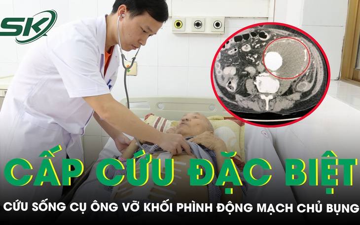Suýt tử vong vì vỡ khối phình động mạch chủ bụng
