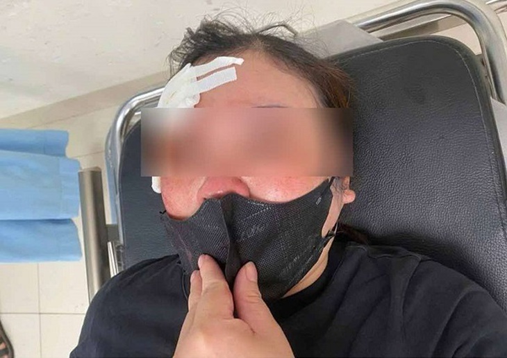 Xin tránh đường không được, người đàn ông đi ô tô dùng dùi cui vụt vào đầu một phụ nữ - Ảnh 1.
