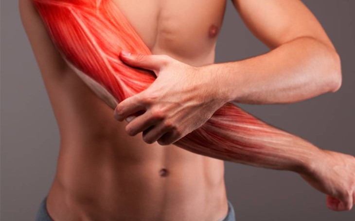 Viêm cơ, áp xe cơ: Nguyên nhân, triệu chứng, cách điều trị và phòng ngừa