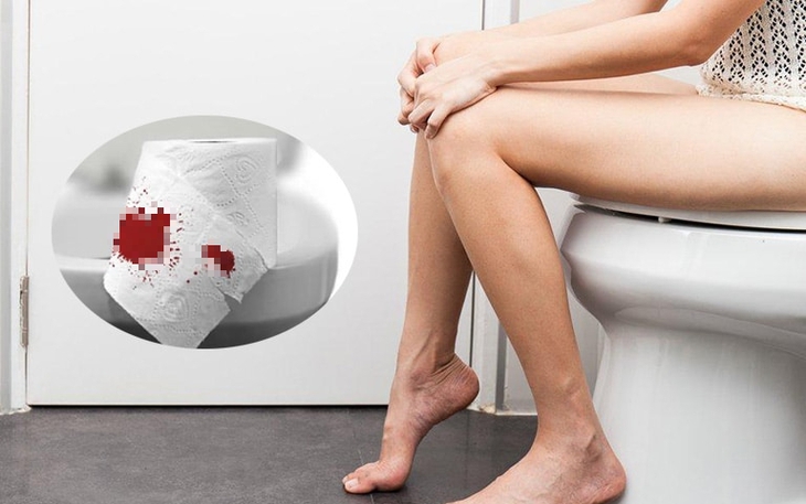 Ra máu âm đạo bất thường có phải là dấu hiệu mắc ung thư cổ tử cung?- Ảnh 1.