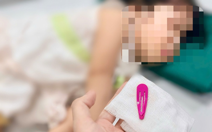 Thót tim gắp chiếc kẹp tóc sắc nhọn dài 5 cm trong dạ dày bé gái