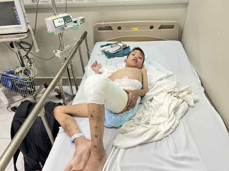 Con lớn bị tâm thần, người cha nghèo cầu cứu cộng đồng để điều trị cho con trai út mắc bệnh hiếm gặp- Ảnh 2. Con lớn bị tâm thần, người cha nghèo cầu cứu cộng đồng để điều trị cho con trai út mắc bệnh hiếm gặp- Ảnh 2.