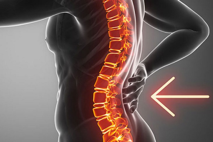 Thay đổi lối sống để phòng thoái hóa cột sống lưng- Ảnh 1.