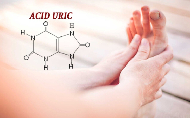 Triệu chứng tăng axit uric cần chú ý
