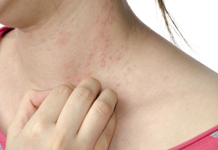 6 dấu hiệu cảnh báo gan bị nhiễm độc bạn đã biết chưa?- Ảnh 1.