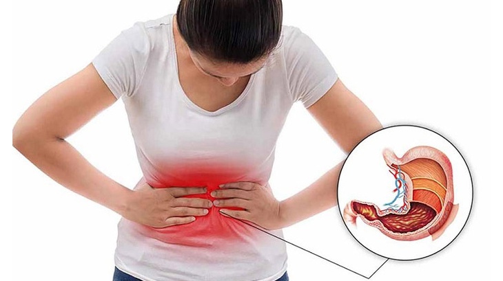 Vì sao không dùng vitamin C cùng thuốc kháng acid chứa nhôm?- Ảnh 1.
