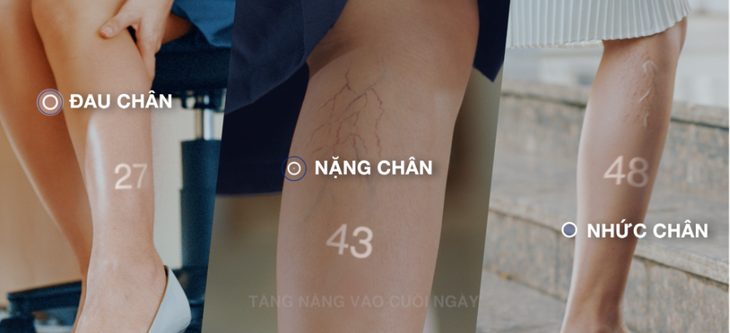 Điều trị hiệu quả triệu chứng suy giãn tĩnh mạch từ chiết xuất vỏ cam non- Ảnh 1.