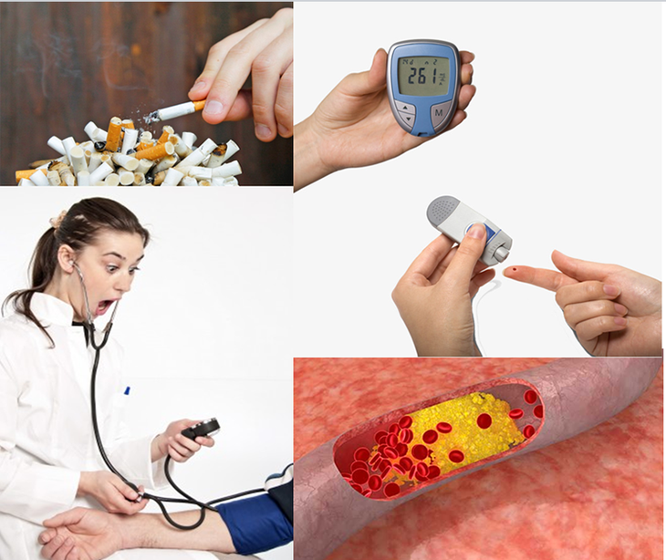 Động mạch ngoại biên