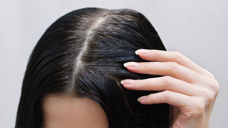 Nên ăn gì để làm đen tóc?- Ảnh 1.