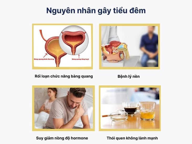 Tiểu đêm – 'Kẻ thù thầm lặng' của giấc ngủ- Ảnh 2.