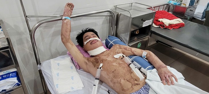 Mong một phép màu cho nam sinh bị bỏng điện cao thế 55% cơ thể- Ảnh 1.