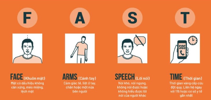 Nhận biết sớm đột quỵ và ngừng tim để cứu đúng cách- Ảnh 2.