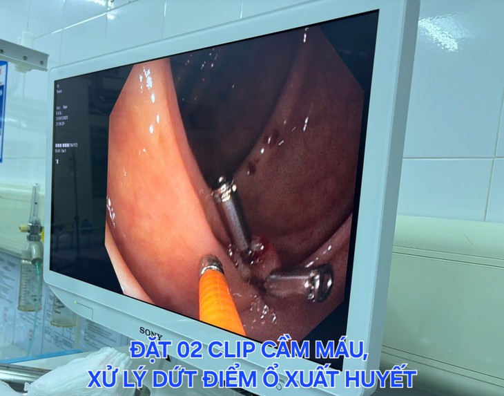 Trắng đêm mưa bão cứu sống bệnh nhân sốc mất máu, chở sản phụ chuyển dạ đến viện- Ảnh 1. Trắng đêm mưa bão cứu sống bệnh nhân sốc mất máu, chở sản phụ chuyển dạ đến viện- Ảnh 1.