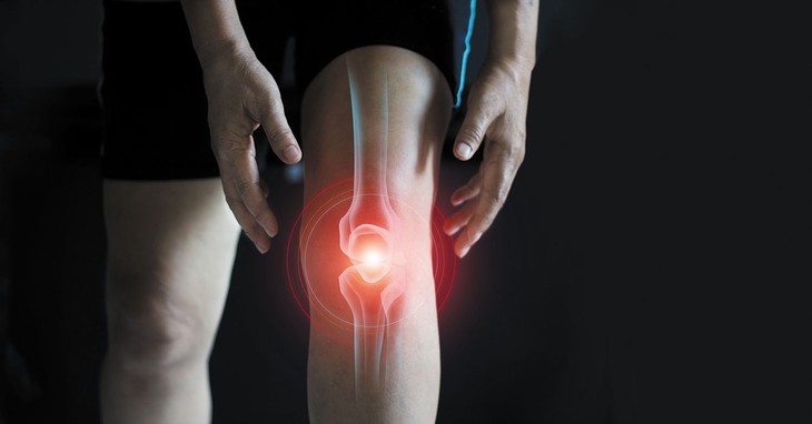 Các thuốc có thể giúp giảm đau đầu gối- Ảnh 2.