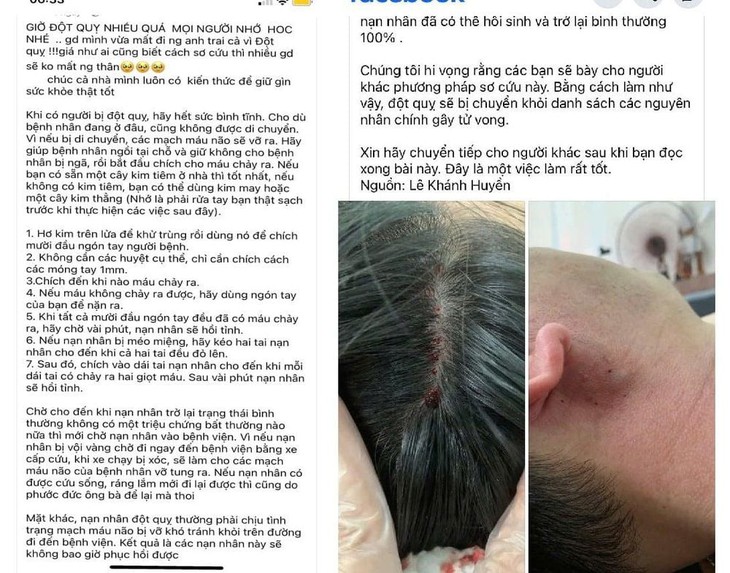 Có nên chích đầu ngón tay khi đột quỵ?- Ảnh 1.
