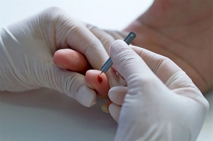 Có nên chích đầu ngón tay khi đột quỵ?- Ảnh 2.